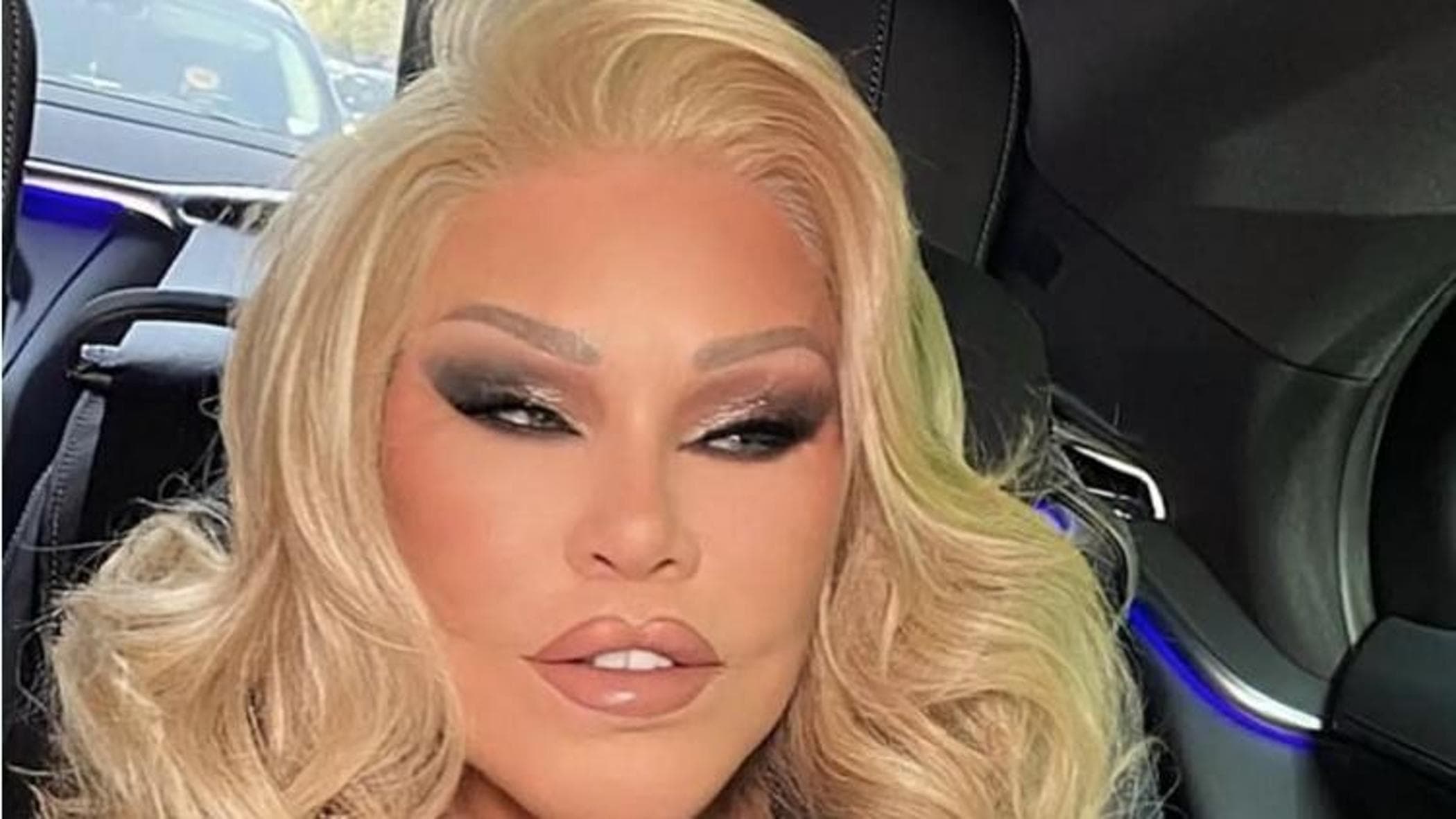 Morta Jocelyn Wildenstein, la "Donna gatto" regina della chirurgia estetica estrema