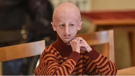 Sammy Basso è morto. Associazione Progeria: “Si è spenta la nostra luce”